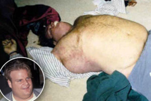 Chris farley autopsy death photo 1