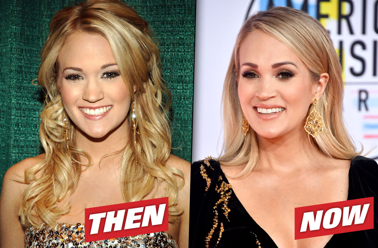 Inside Carrie Underwood's Plastic Surgery Nightmare